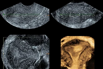 3d-ultrasound-benefits-in-pregnancy-blog-middle-2