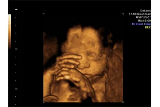 3d-ultrasound-technology-helps-us-see-better-blog-middle-2