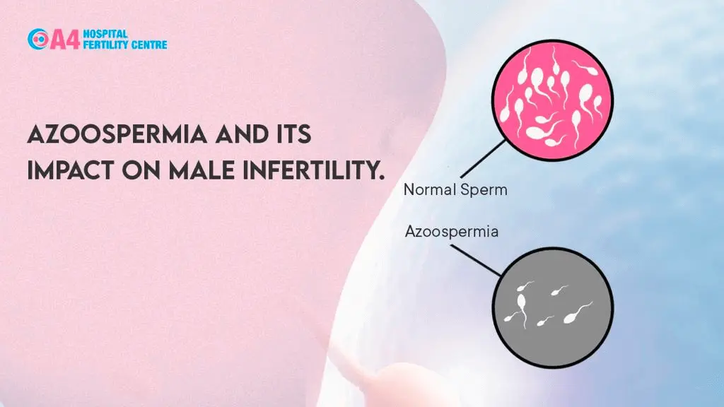 azoospermia-and-its-impact-on-male-infertility