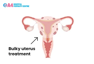 bulky-uterus-treatment-blog-middle-1