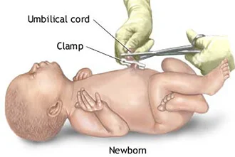 delayed-cord-clamping-blog-middle-1