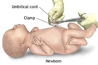 delayed-cord-clamping-blog-middle-2
