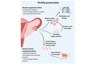 how-to-retain-the-fertility-age-future-paves-way-with-frozen-ovary-blog-middle-1