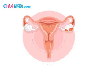 is-ovary-size-important-to-get-pregnant-blog-middle-2
