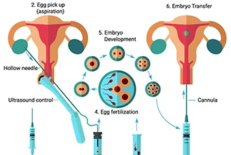 ivf-questions-about-the-procedure-part-1-blog-middle-1