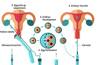 ivf-questions-about-the-procedure-part-1-blog-middle-2