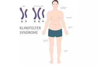 klinefelter-syndrome-or-xxy-syndrome-blog-middle-2