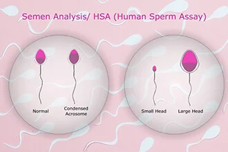 semen-analysis-a-diagnostic-test-blog-middle-2