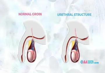 Stricture Urethra Claustrophobia In Your Urethra